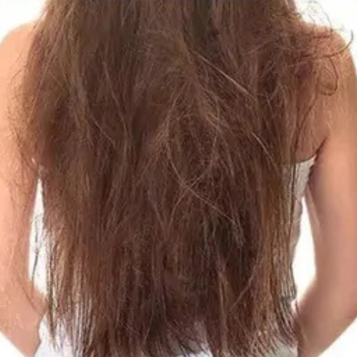 Antes - cabelo ressecado